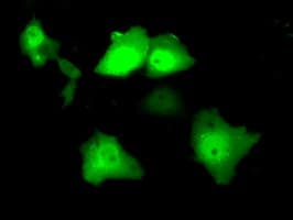 SRR / Serine Racemase Antibody (clone OTI7G6)