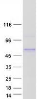 Human ZNF362 Protein (Recombinant Myc-DDK (Flag))