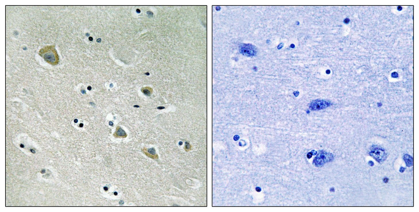 Polyclonal Rabbit anti-Human PAK1 Antibody (phospho-Ser204, IHC, WB)