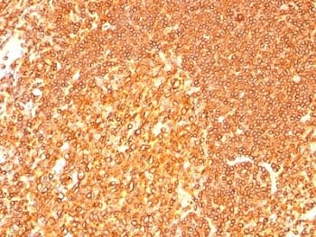 HLA-DRB1 Antibody (clone LN3 + HLA-DRB/1067, Azide-free, BSA-free)