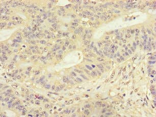 Polyclonal Rabbit anti-Human FMNL3 Antibody (IHC, IF)