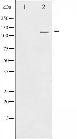 RBL2 / RB2 p130 Antibody