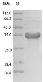 Human SOCS2 Protein (Recombinant GST, N-terminus)