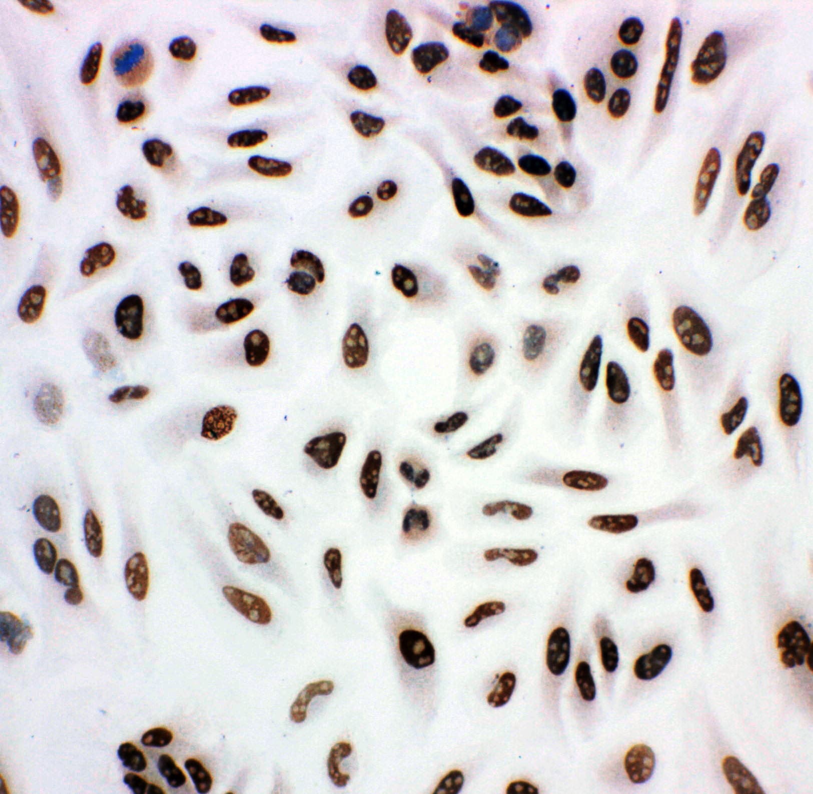 Polyclonal Rabbit anti-Human HDAC3 Antibody (aa1-18, IHC, WB)