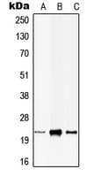 CIB1 / KIP Antibody (Internal)