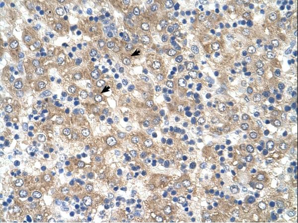 Polyclonal Rabbit anti-Human TSPAN32 / PHEMX Antibody (FITC, aa101-150, IHC, WB)