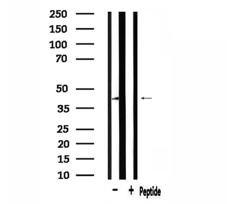 Polyclonal Rabbit anti-Human NFYA Antibody (IF, WB)