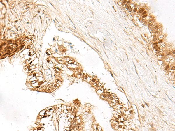LDHA / LDH1 Antibody