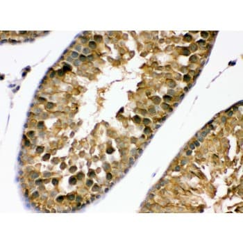 PDPK1 / PDK1 Antibody (aa524-556)