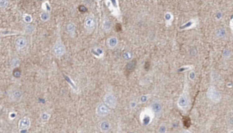 KCNMB4 Antibody