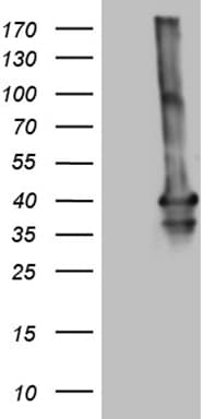 MEOX1 Antibody (clone OTI5D8)
