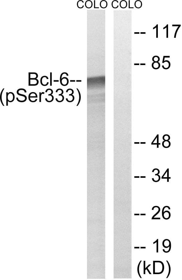BCL6 Antibody (phospho-Ser333)