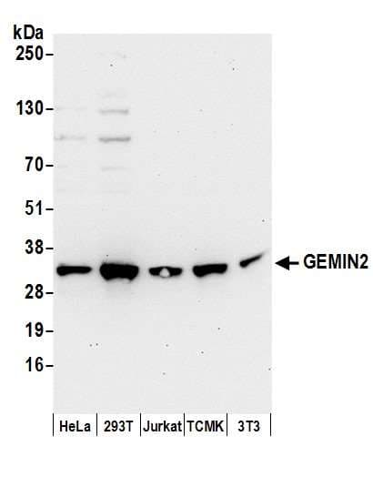 SIP1 Antibody (aa25-75)