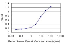 IHC-plus™ KPI-2 / LMTK2 Antibody (clone 3G1)
