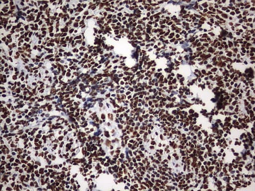 Monoclonal Mouse anti-Human HNRPM / HNRNPM Antibody (clone OTI1F6, aa1-261, IHC, WB)