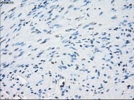 AURKC / Aurora C Antibody (clone OTI2B7)