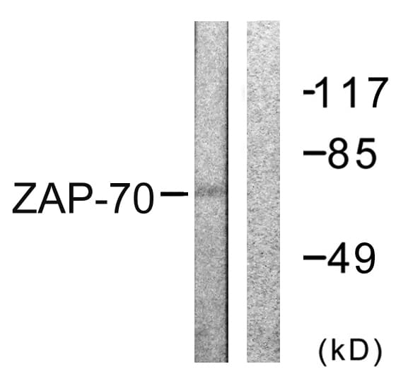 ZAP70 Antibody (aa258-307)