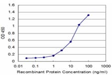 Monoclonal Mouse anti-Human PEX6 Antibody (clone 3G3, WB)