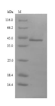 Ambrosia artemisiifolia PLY1 / Pectate lyase 1 Protein (Recombinant 6His, N-terminus)