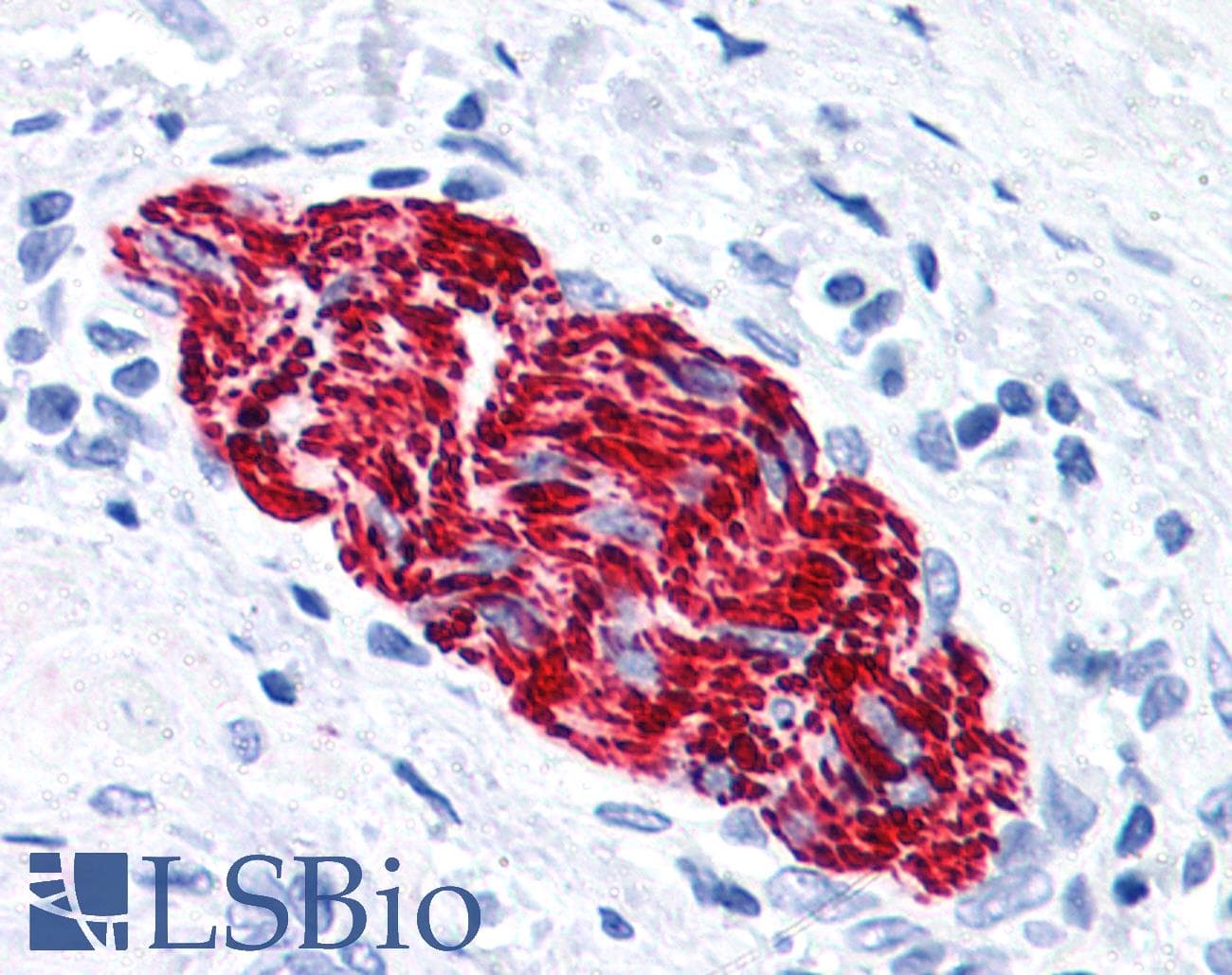IHC-plus™ Monoclonal Mouse anti-Human NEFH / NF-H Antibody (clone NF-05, IHC, WB)