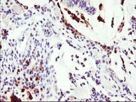 SDS Antibody (clone OTI3D3)