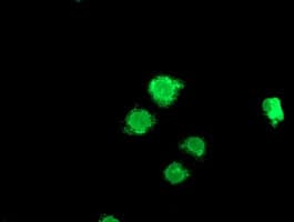 LPL / Lipoprotein Lipase Antibody (clone OTI4G2)