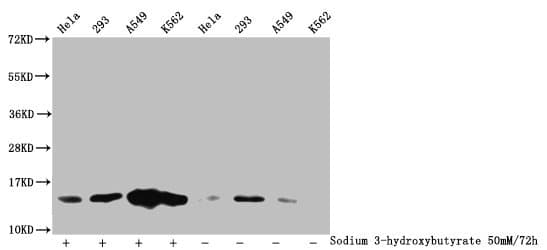 HIST1H2BN Antibody