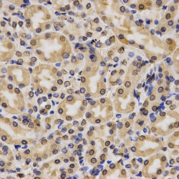 Histone H3 Antibody (Methyl-Lys4)