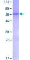 Human MYOG / Myogenin Protein (Recombinant GST)