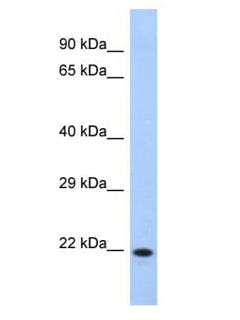 CCDC27 Antibody (aa65-114)