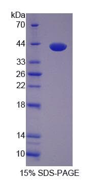 Mouse CARP / ANKRD1 Protein (Recombinant His-S)