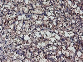 Complement C1s Antibody (clone OTI4E3)