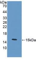 CALCA Antibody (Cy3)