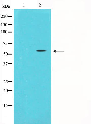 CHEK1 / CHK1 Antibody