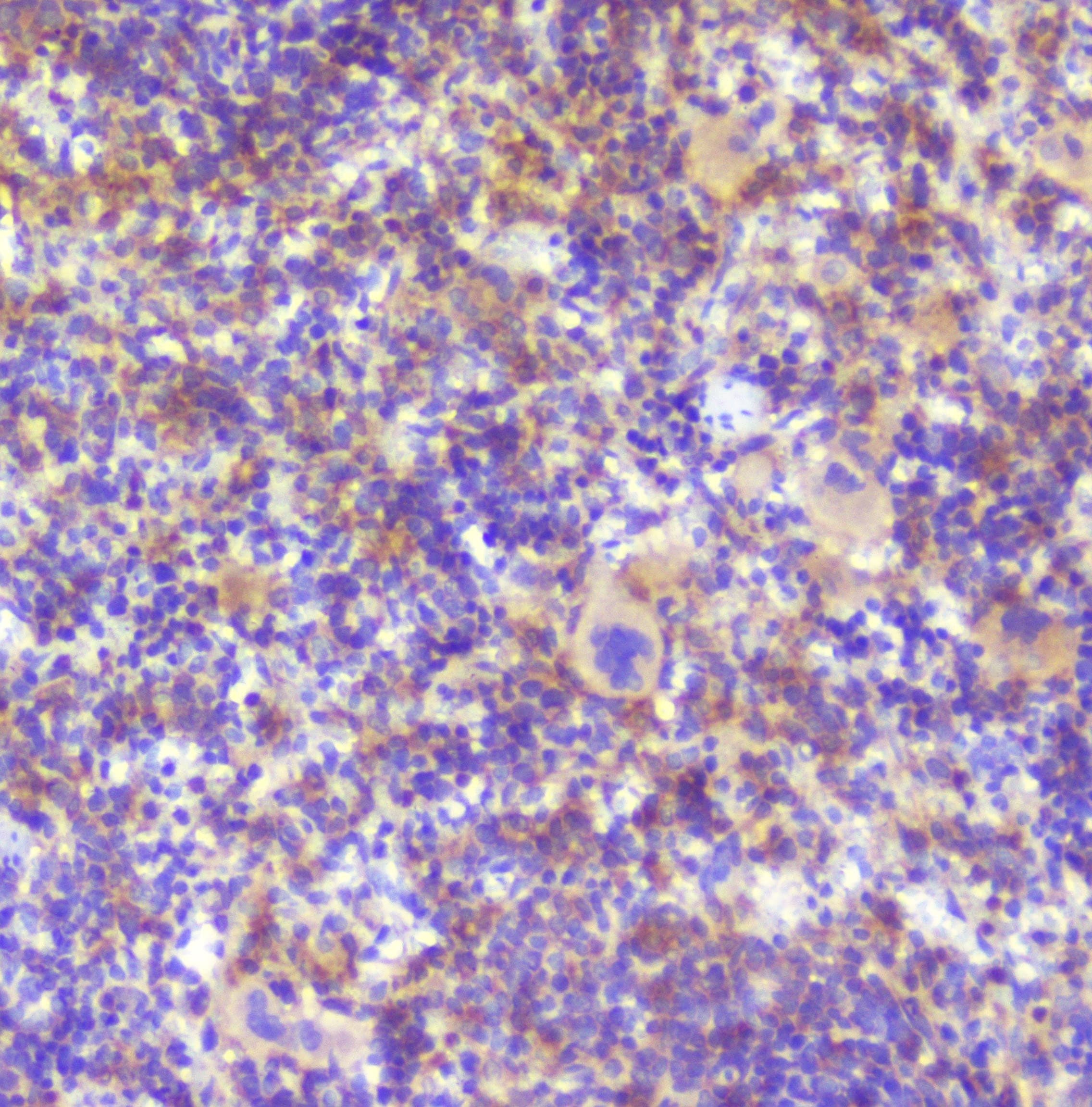 Polyclonal Rabbit anti-Human RP2 Antibody (IHC, WB)