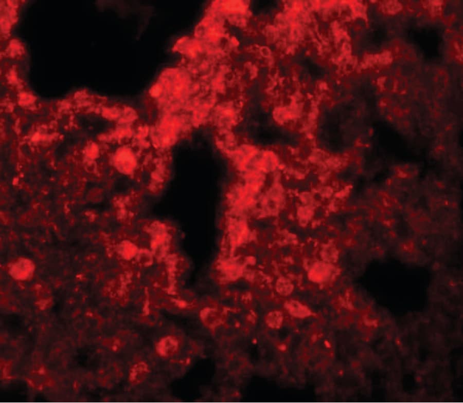 IHC-plus™ SRPX2 Antibody