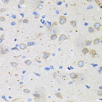 GLCNE / GNE Antibody