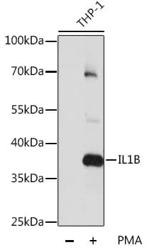 IL-1B / IL-1 Beta Antibody