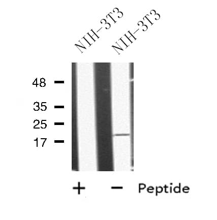 Polyclonal Rabbit anti-Human MRAP Antibody (IHC, WB)