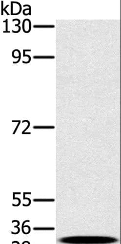 Polyclonal Rabbit anti-Human RAB27A / RAB27 Antibody (IHC, WB)