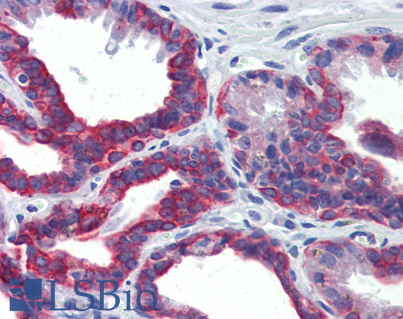 IHC-plus™ KRT7 / CK7 / Cytokeratin 7 Antibody (clone 5D12)