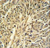 IMPDH2 Antibody (aa180-210)