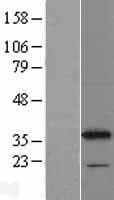 CYB5R1 Protein (Over-Expression Lysate Myc-DDK (Flag))