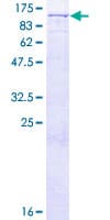 Human VPS16 Protein (Recombinant GST)