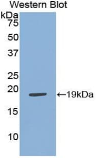 ADM / Adrenomedullin Antibody (aa31-187, APC)