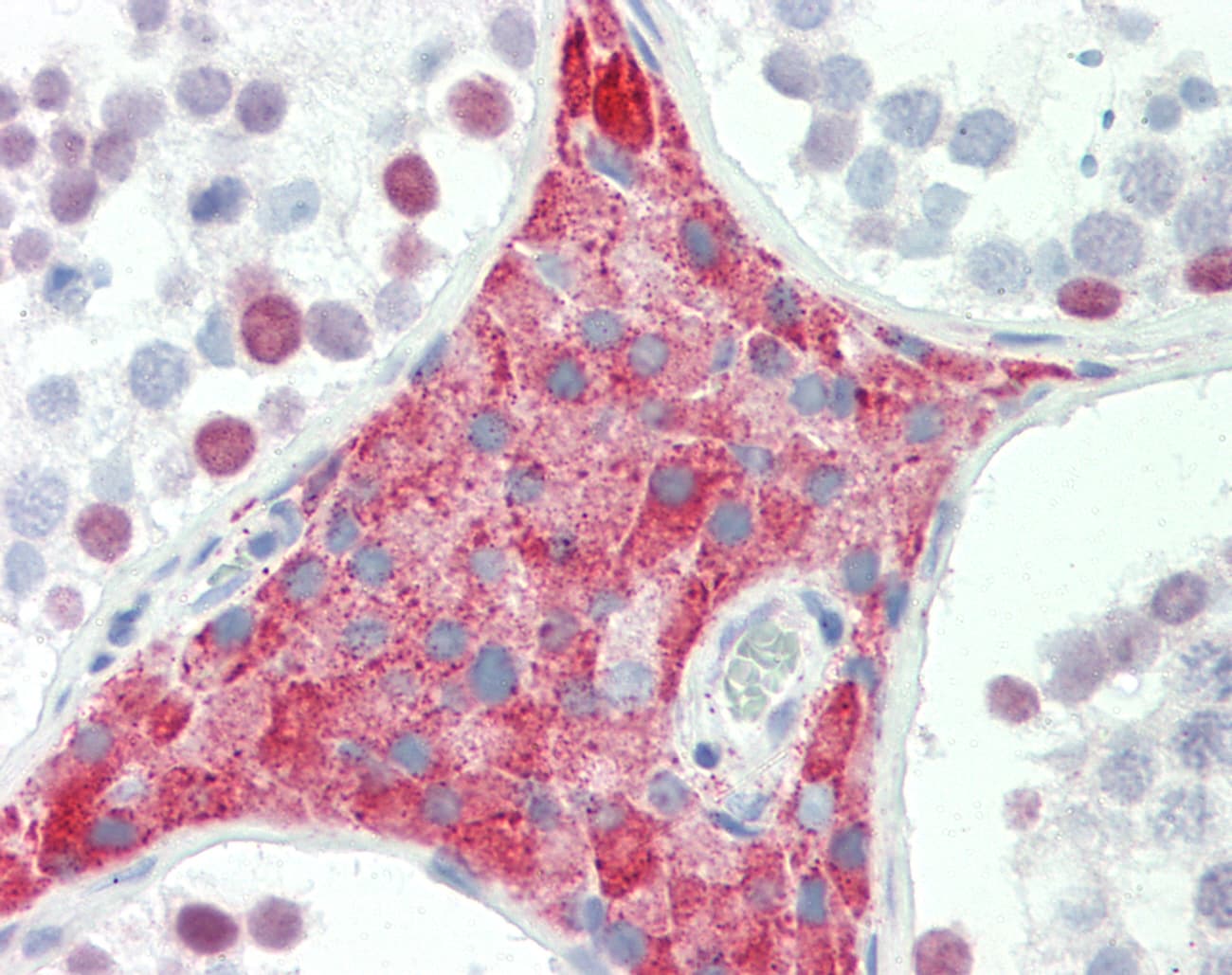 Polyclonal Rabbit anti-Human CEB1 / HERC5 Antibody (aa900-949, IHC, WB)