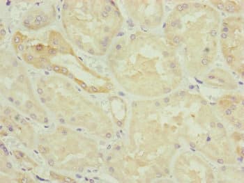 HAUS8 Antibody
