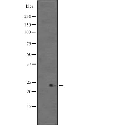 WARS2 Antibody