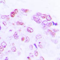 Polyclonal Rabbit anti-Human ATF2 Antibody (Internal, IHC, WB)