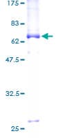 Human SUN5 / SPAG4L Protein (Recombinant GST)